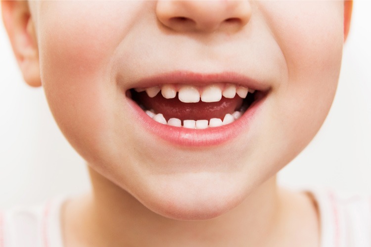 Closeup of a child's sensitive teeth